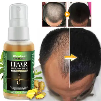 Истончение волос Эффективные видимые результаты роста волос Имбирь способствует росту волос Клинически доказано